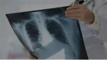 Chẩn đoán hình ảnh